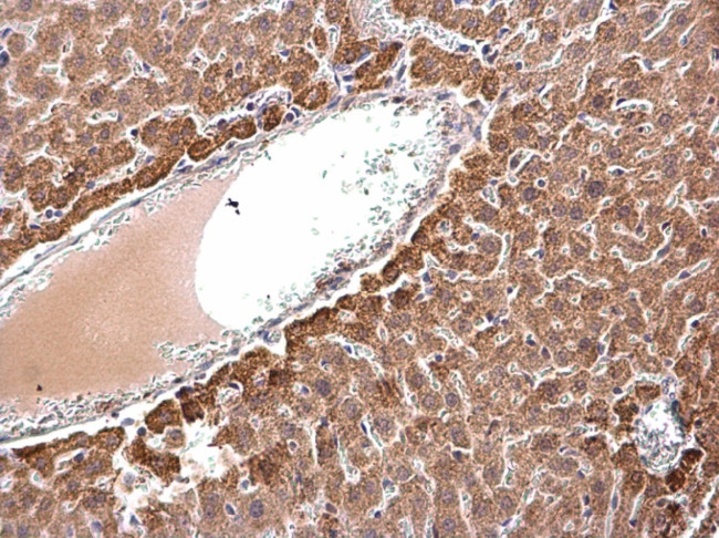 ACAA2 Antibody in Immunohistochemistry (Paraffin) (IHC (P))