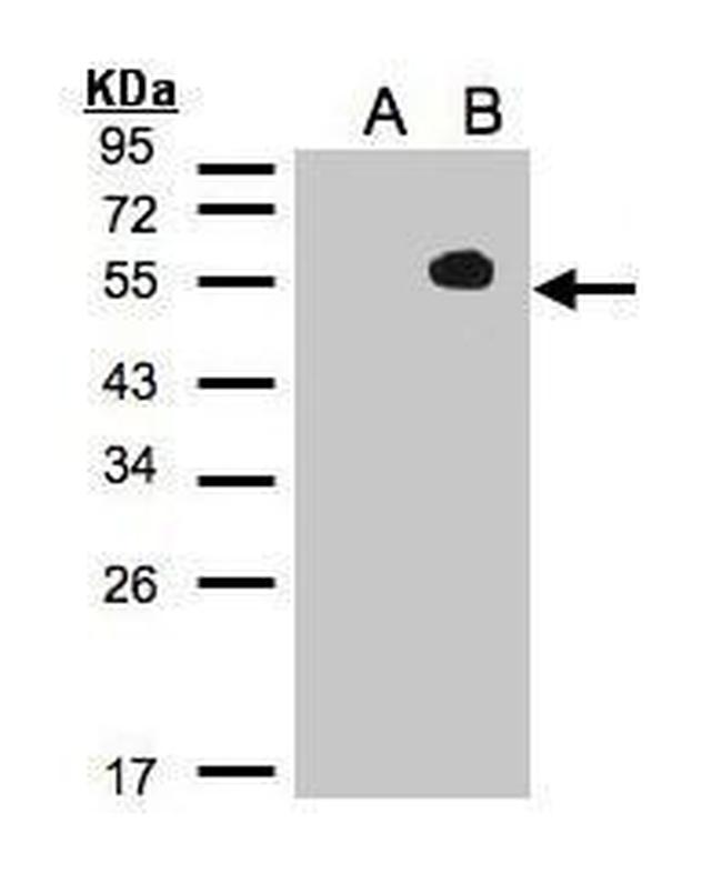 TAB1 Antibody in Western Blot (WB)