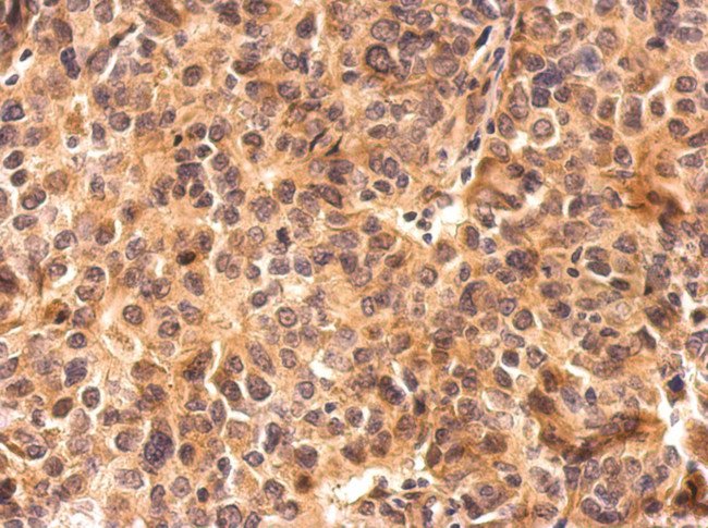 PRMT4 Antibody in Immunohistochemistry (Paraffin) (IHC (P))