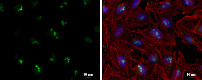 RNAse H2A Antibody in Immunocytochemistry (ICC/IF)