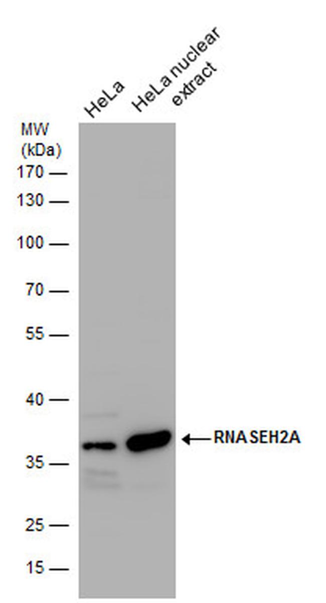 RNAse H2A Antibody in Western Blot (WB)