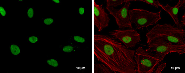 Phospho-SLU7 (Ser513, Ser515) Antibody in Immunocytochemistry (ICC/IF)