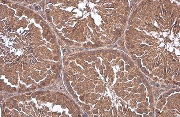 GNA13 Antibody in Immunohistochemistry (Paraffin) (IHC (P))