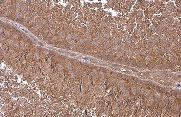 GNA13 Antibody in Immunohistochemistry (Paraffin) (IHC (P))