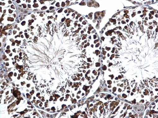 RUVBL2 Antibody in Immunohistochemistry (Paraffin) (IHC (P))