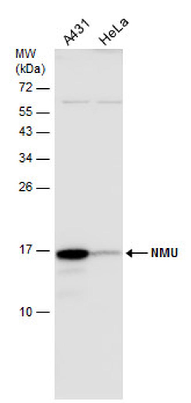 Neuromedin U Antibody in Western Blot (WB)