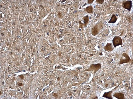 TMP21 Antibody in Immunohistochemistry (Paraffin) (IHC (P))