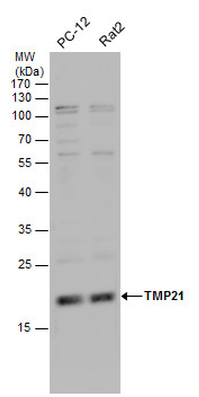 TMP21 Antibody in Western Blot (WB)