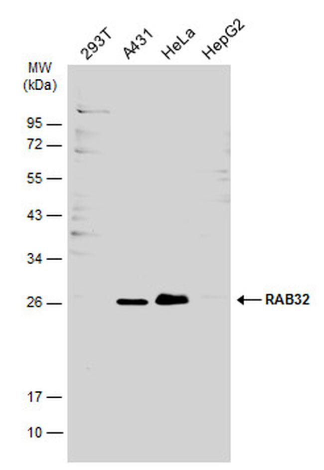 RAB32 Antibody in Western Blot (WB)