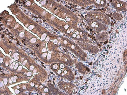 Coronin 1A Antibody in Immunohistochemistry (Paraffin) (IHC (P))