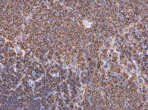 Coronin 1A Antibody in Immunohistochemistry (Paraffin) (IHC (P))