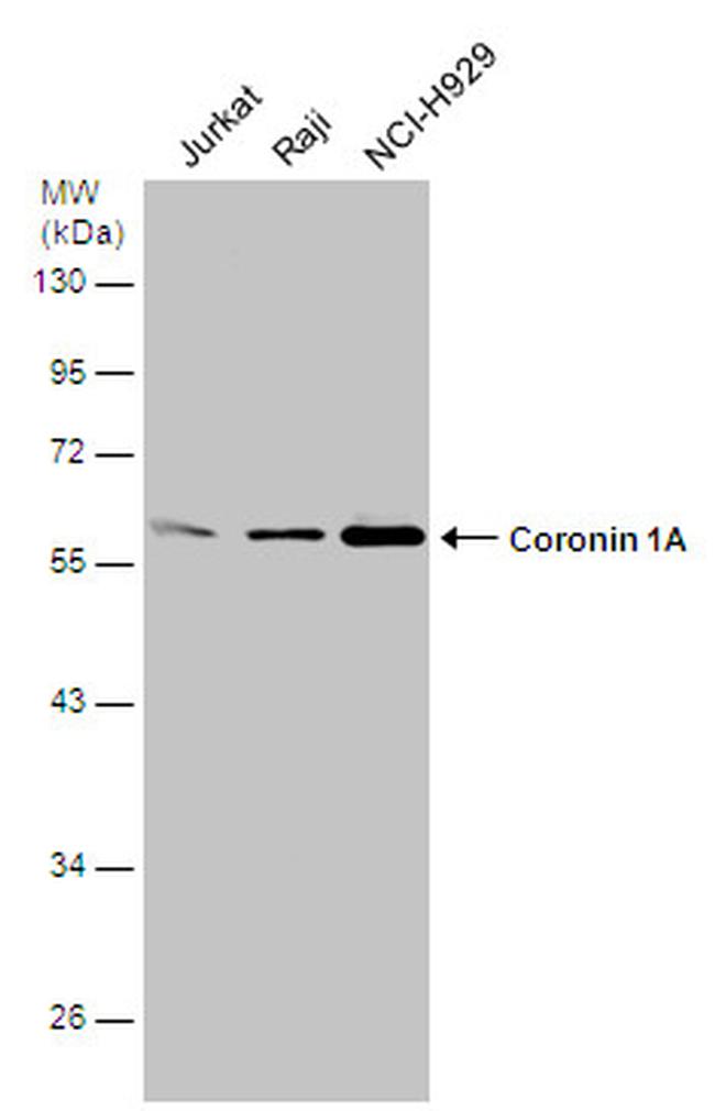 Coronin 1A Antibody in Western Blot (WB)