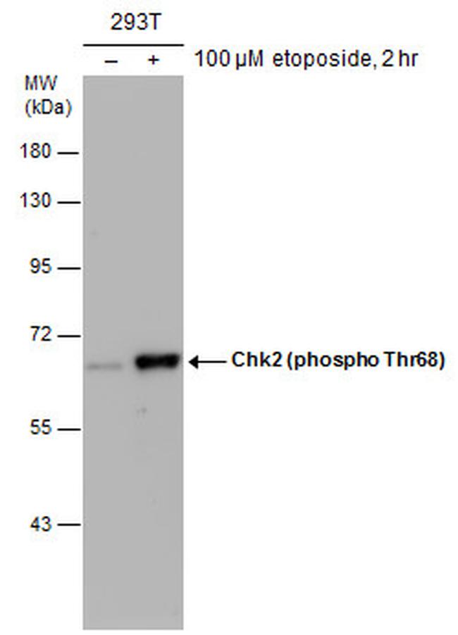 Phospho-CHK2 (Thr68) Antibody in Western Blot (WB)