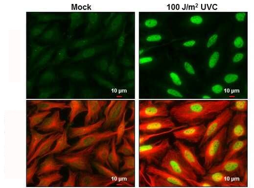 Phospho-CHK2 (Thr68) Antibody in Immunocytochemistry (ICC/IF)