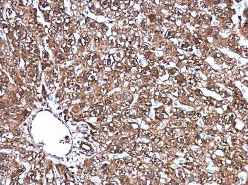 DJ-1 Antibody in Immunohistochemistry (Paraffin) (IHC (P))