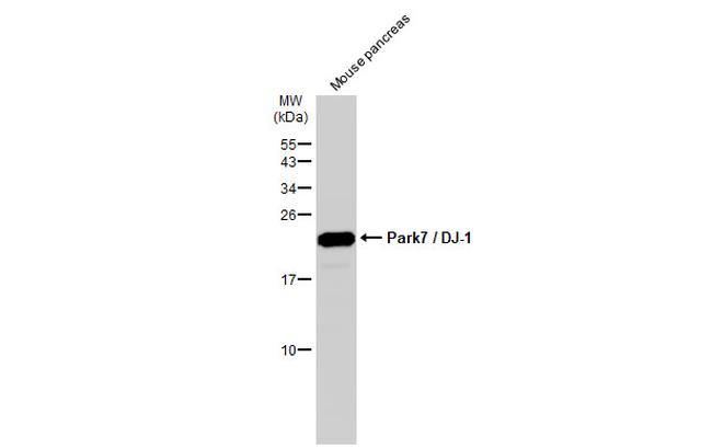 DJ-1 Antibody in Western Blot (WB)