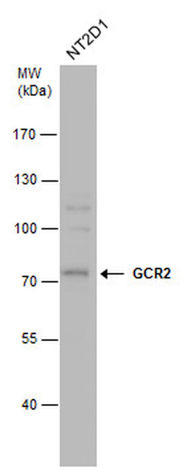 ECD Antibody in Western Blot (WB)