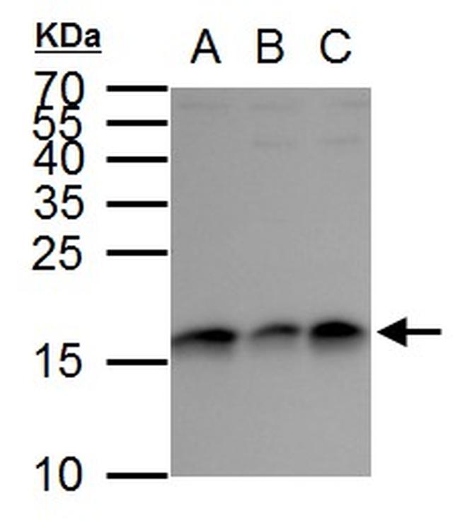 GABARAP Antibody in Western Blot (WB)