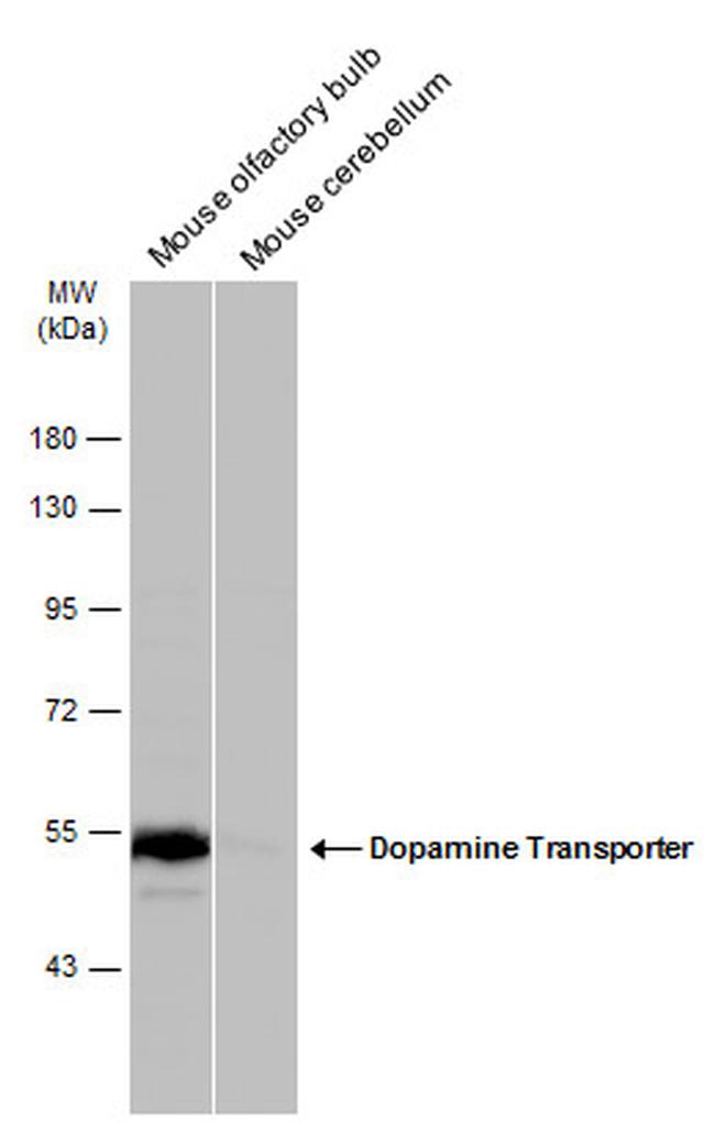 Dopamine Transporter Antibody in Western Blot (WB)