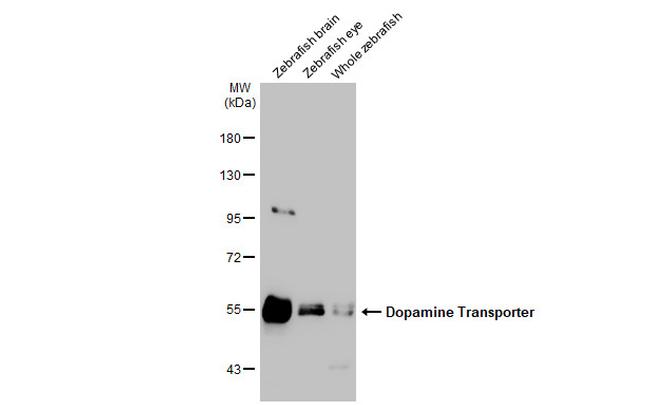 Dopamine Transporter Antibody in Western Blot (WB)