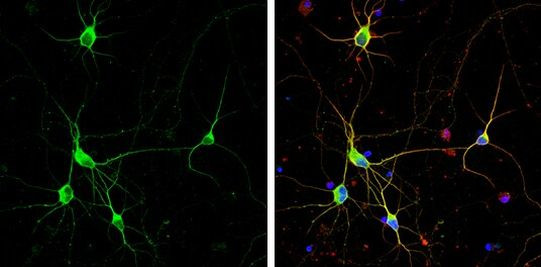 Dopamine Transporter Antibody in Immunocytochemistry (ICC/IF)