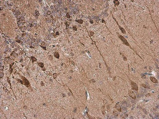 Dopamine Transporter Antibody in Immunohistochemistry (Paraffin) (IHC (P))