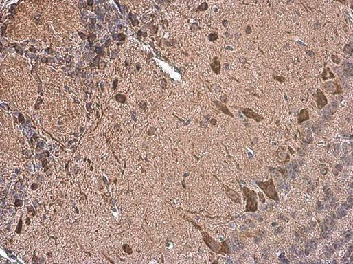 Dopamine Transporter Antibody in Immunohistochemistry (Paraffin) (IHC (P))