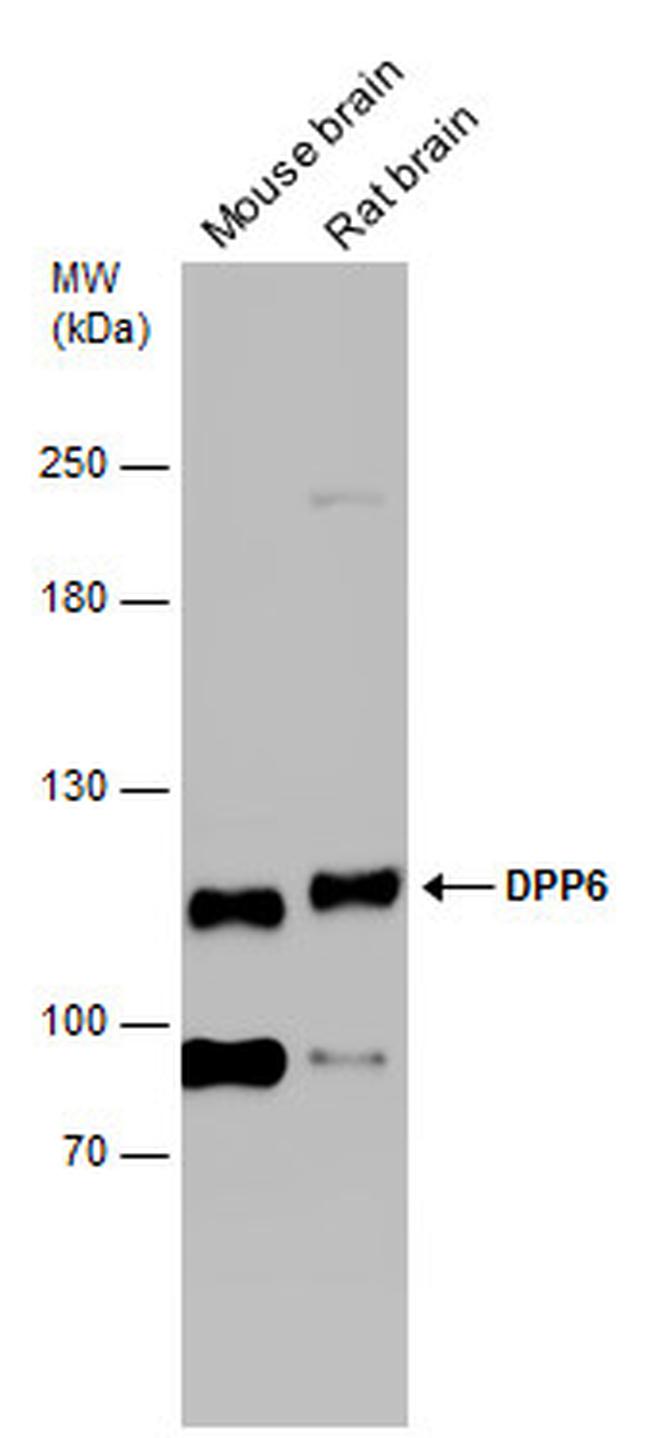 DPP6 Antibody in Western Blot (WB)