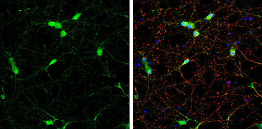 NSE Antibody in Immunocytochemistry (ICC/IF)