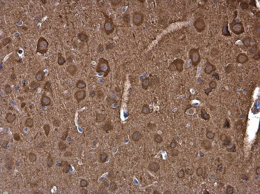 NSE Antibody in Immunohistochemistry (Paraffin) (IHC (P))