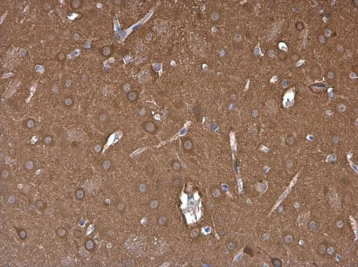 NSE Antibody in Immunohistochemistry (Paraffin) (IHC (P))