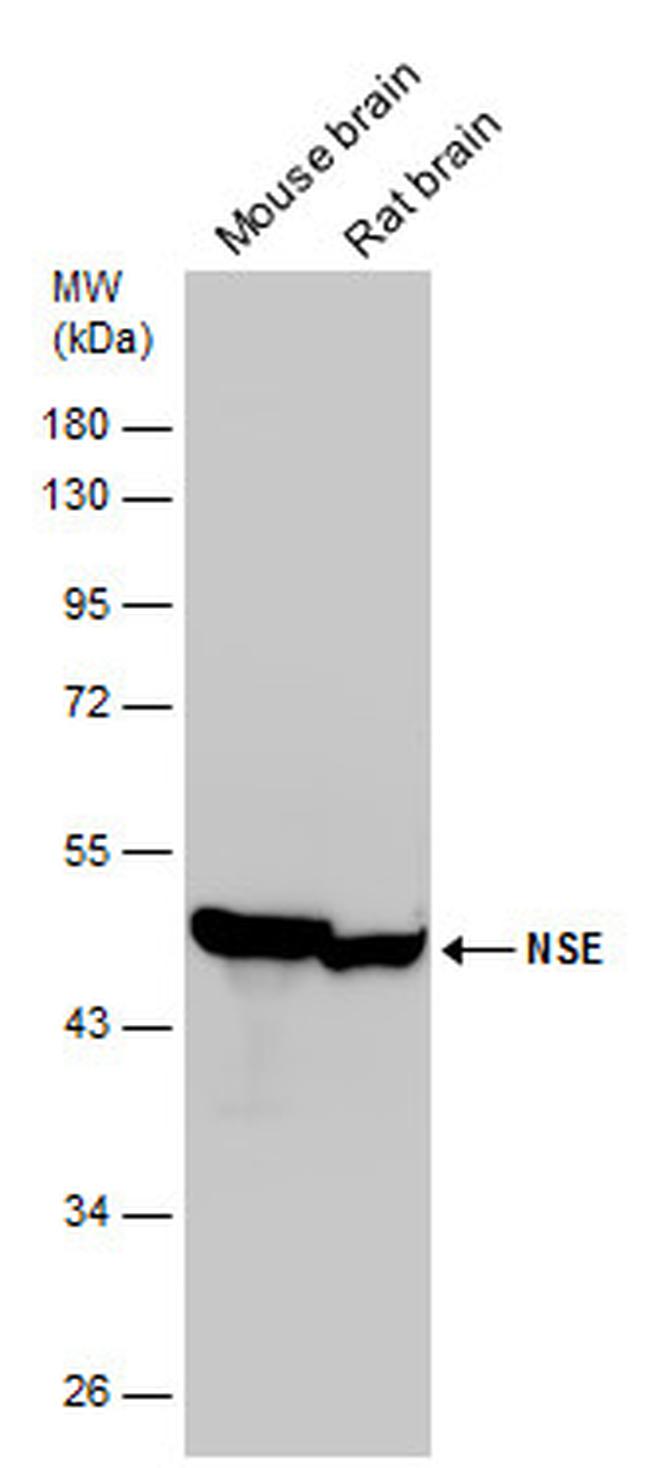 NSE Antibody in Western Blot (WB)