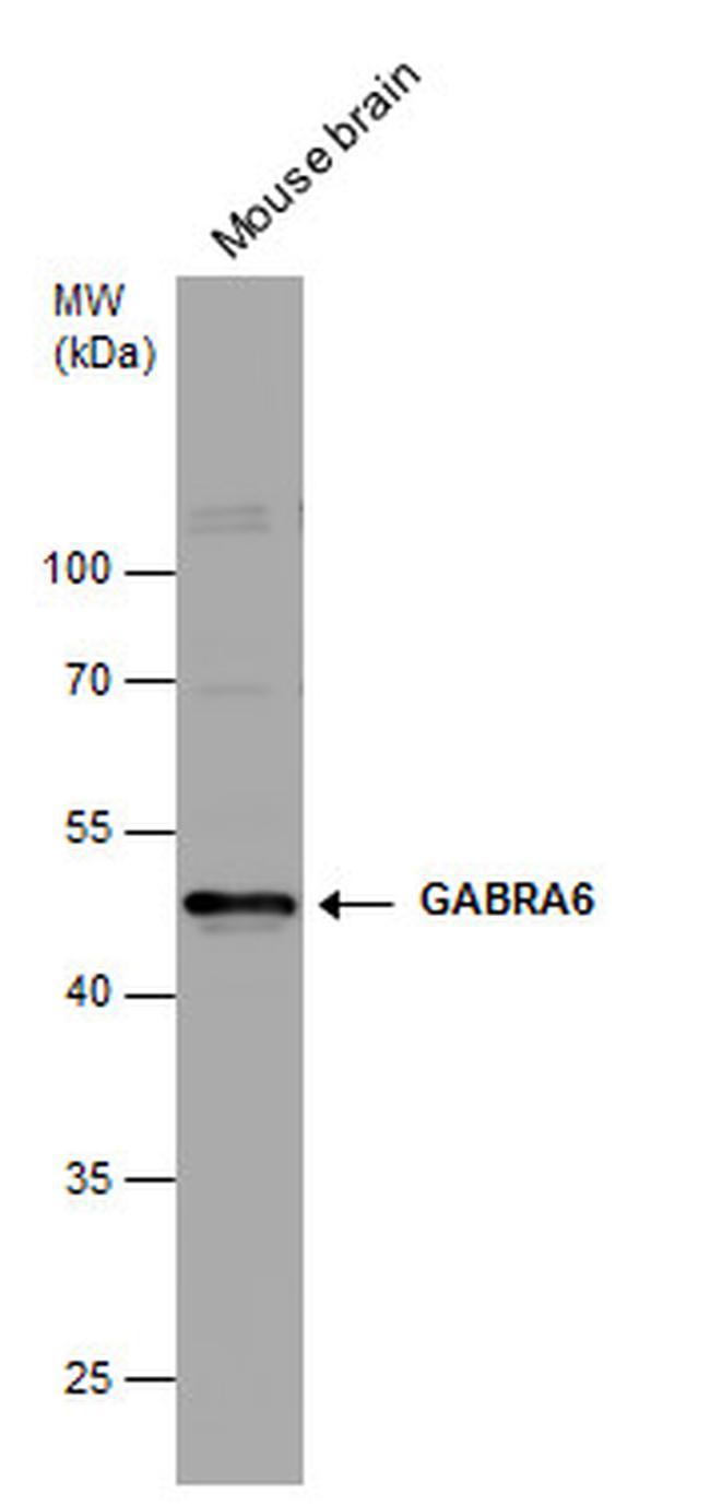 GABRA6 Antibody in Western Blot (WB)