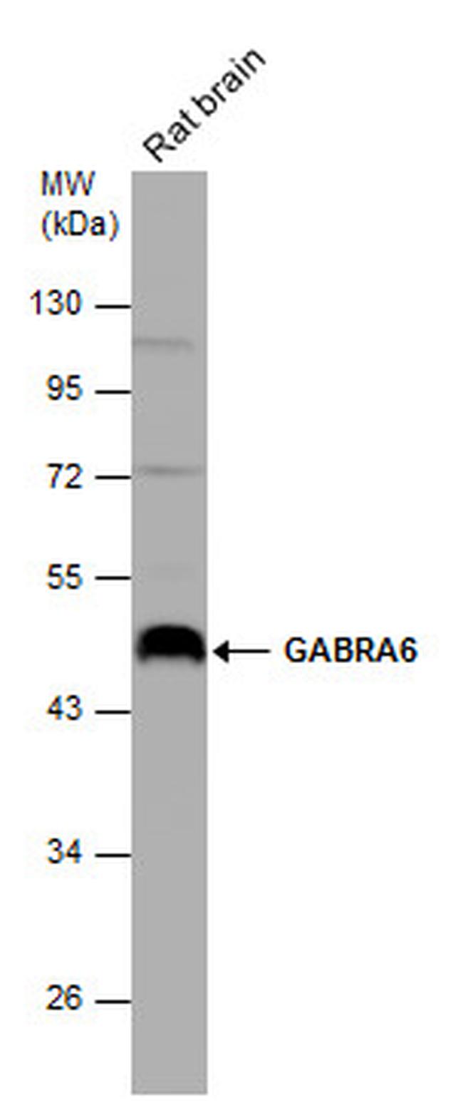 GABRA6 Antibody in Western Blot (WB)