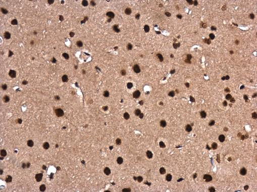 LIM1 Antibody in Immunohistochemistry (Paraffin) (IHC (P))