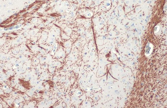 MBP Antibody in Immunohistochemistry (Paraffin) (IHC (P))