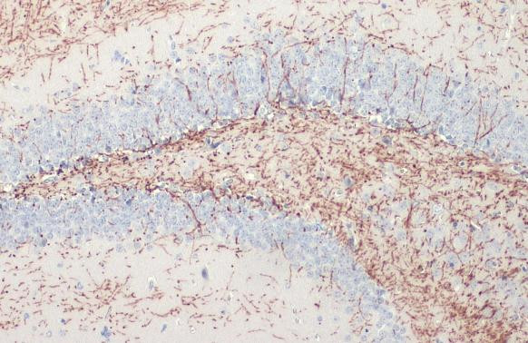 MBP Antibody in Immunohistochemistry (Paraffin) (IHC (P))