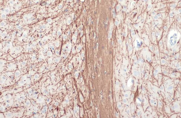 MBP Antibody in Immunohistochemistry (Paraffin) (IHC (P))