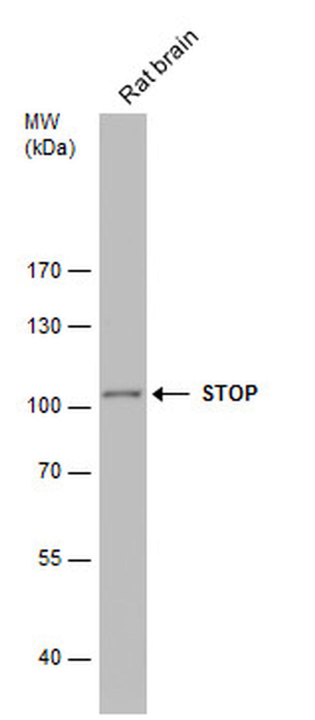 MAP6 Antibody in Western Blot (WB)