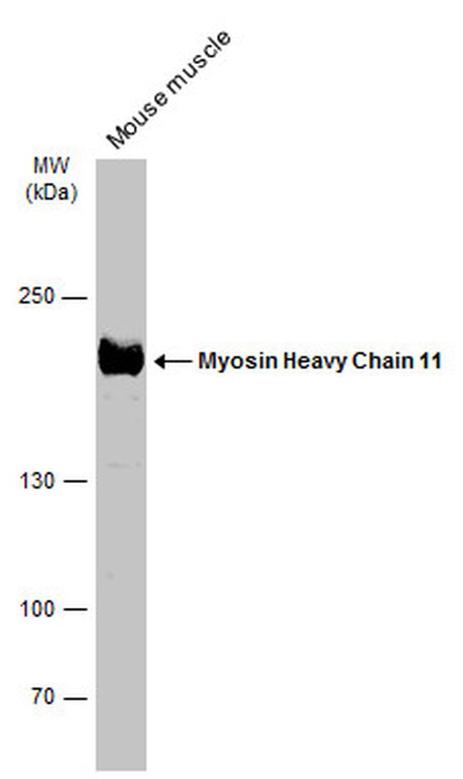 MYH11 Antibody in Western Blot (WB)