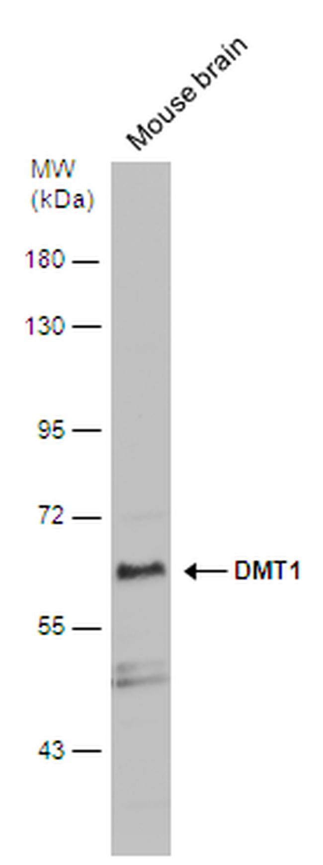 SLC11A2 Antibody in Western Blot (WB)