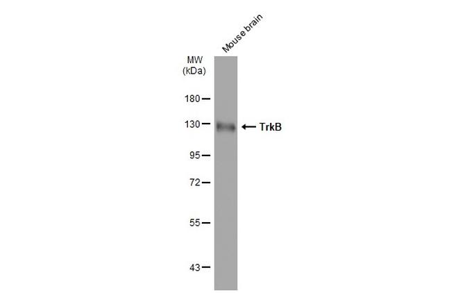 TrkB Antibody in Western Blot (WB)