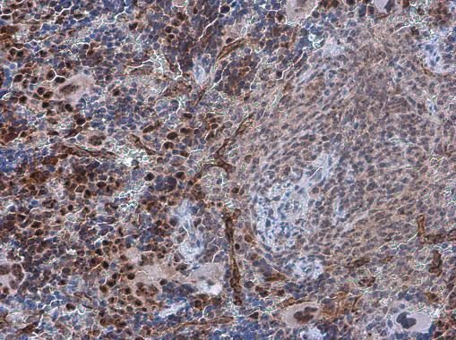 Phospho-PDCD4 (Ser457) Antibody in Immunohistochemistry (Paraffin) (IHC (P))