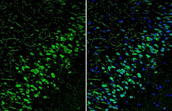 Reelin Antibody in Immunohistochemistry (Frozen) (IHC (F))