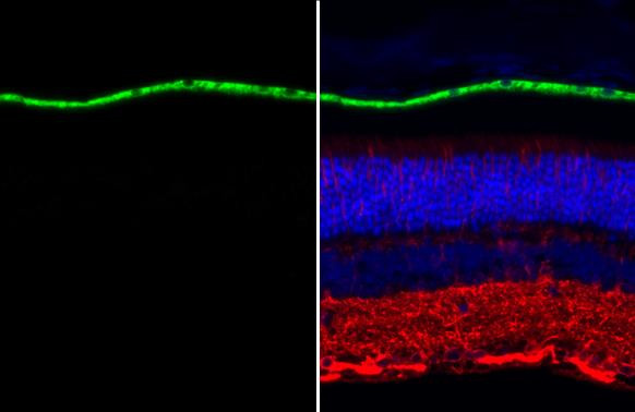 RPE65 Antibody in Immunohistochemistry (Paraffin) (IHC (P))