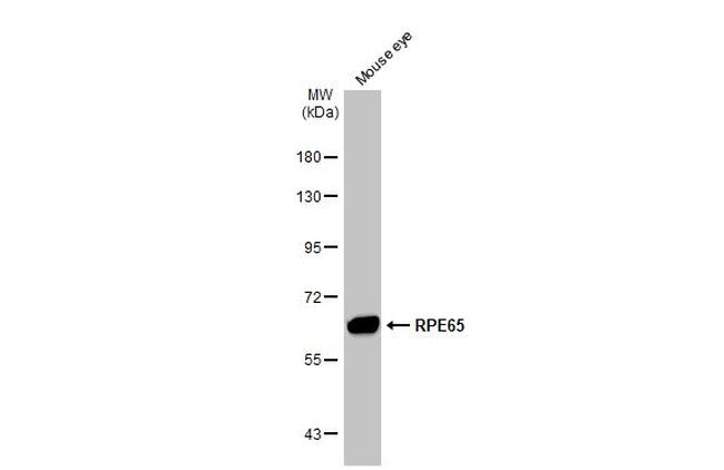 RPE65 Antibody in Western Blot (WB)