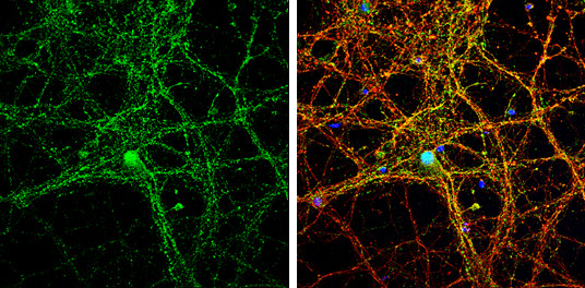 pan Synuclein Antibody in Immunocytochemistry (ICC/IF)