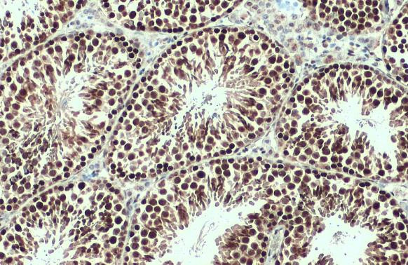 Brachyury Antibody in Immunohistochemistry (Paraffin) (IHC (P))