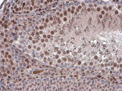 Brachyury Antibody in Immunohistochemistry (Paraffin) (IHC (P))