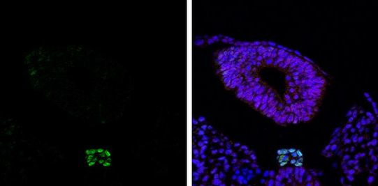 Brachyury Antibody in Immunohistochemistry (Paraffin) (IHC (P))